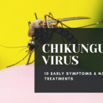 Chikungunya Virus: Mosquito Vector, Symptoms & Natural Remedies